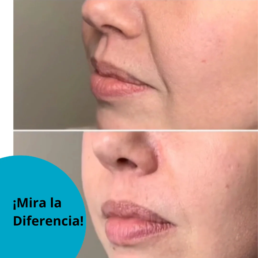 Parche Antiarrugas Gel Mejilla 6 Parches + ¡OFERTA EXCLUSIVA! ENVÍO GRATIS 🎁